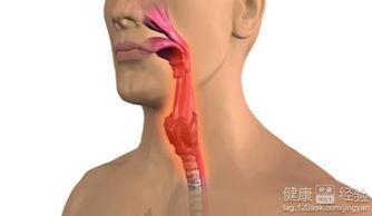 咽炎可以吃茭瓜吗,缓解不适